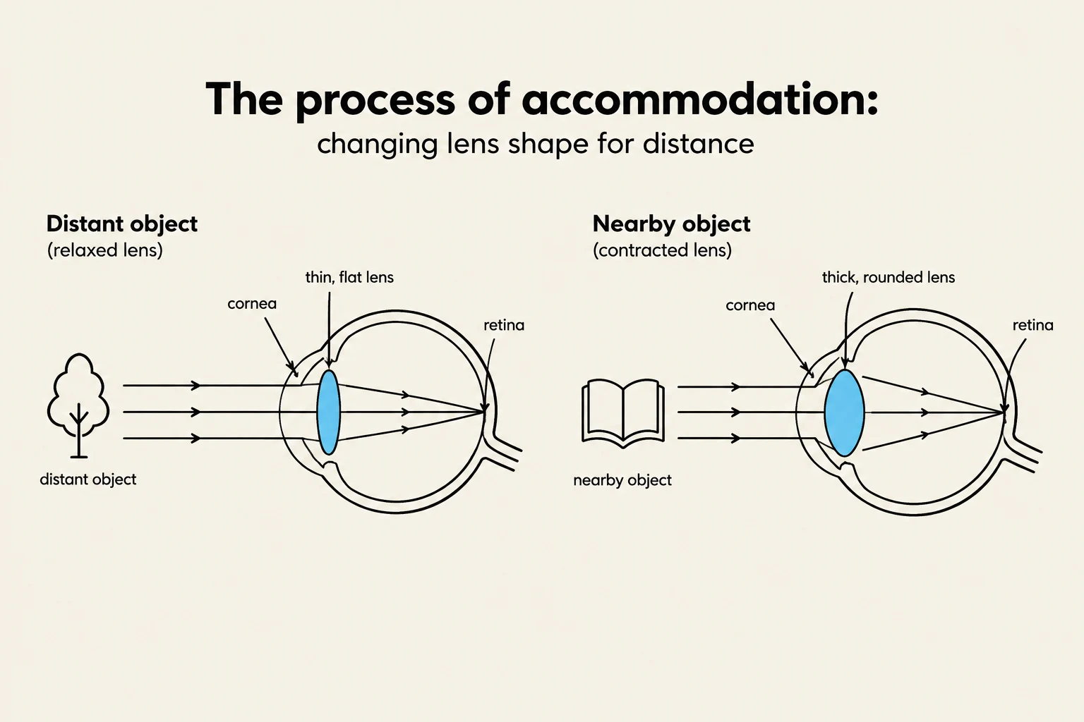 Diagram illustrating the process of accommodation in the human eye, showing how the lens changes shape to focus on distant and nearby objects.