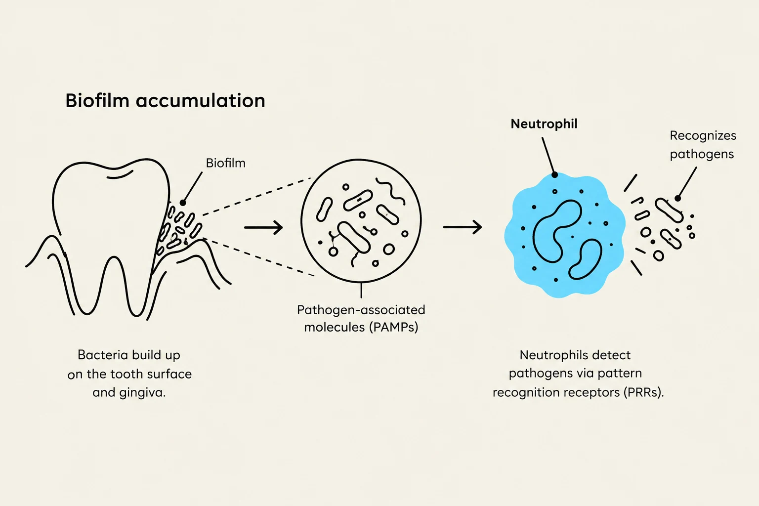 This diagram illustrates the process of biofilm accumulation on teeth, where bacteria build up and trigger a neutrophil response to recognize and combat pathogens.