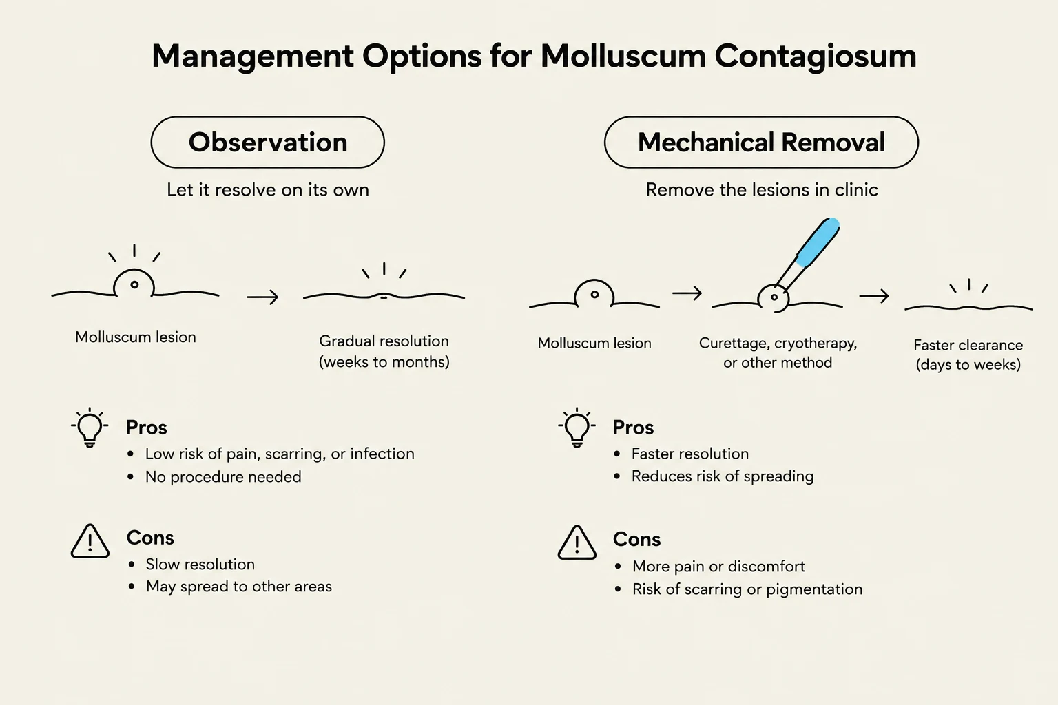 This diagram illustrates management options for Molluscum Contagiosum, detailing observation and mechanical removal methods with their respective pros and cons.