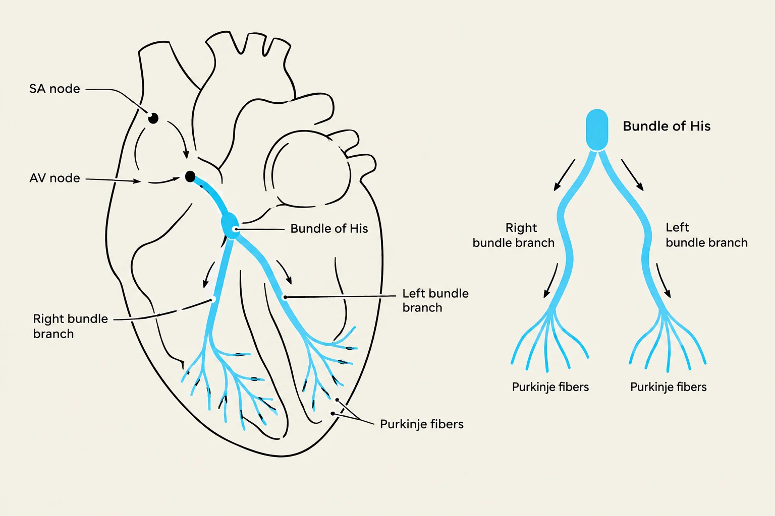 Diagram illustrating the electrical conduction system of the heart, including the SA node, AV node, Bundle of His, bundle branches, and Purkinje fibers.