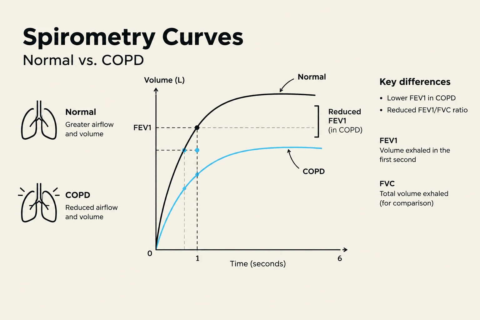 This graph illustrates spirometry curves comparing normal lung function with that of COPD, highlighting differences in airflow and volume.