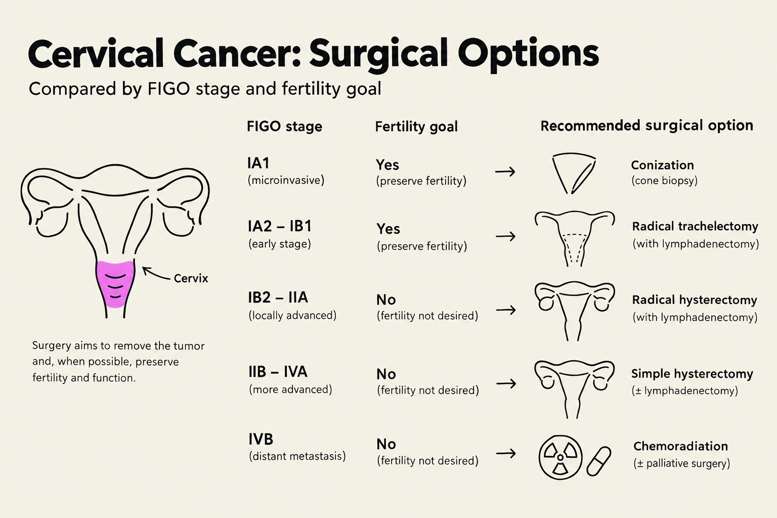 This chart outlines surgical options for cervical cancer, categorized by FIGO stage and fertility goals. It details procedures like conization, radical trachelectomy, radical hysterectomy, simple hysterectomy, and chemoradiation, along with their indications and potential impact on fertility.