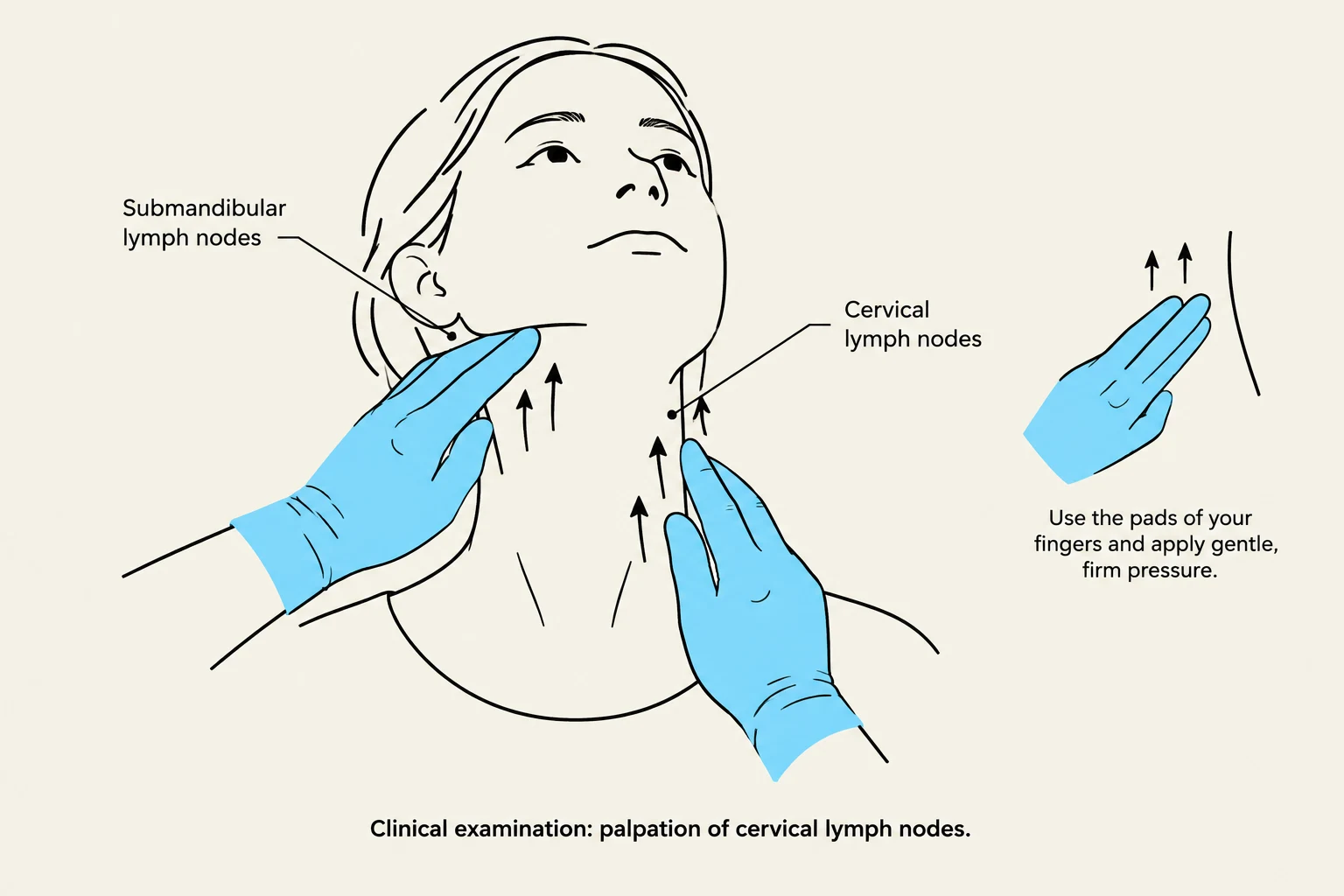 Illustration showing the palpation of cervical and submandibular lymph nodes.