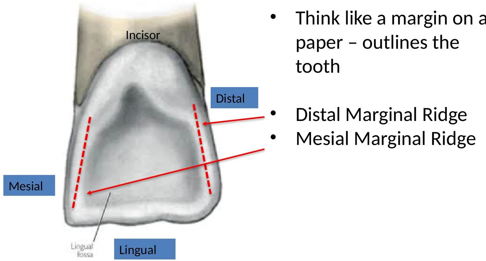 Diagram illustrating the mesial and distal marginal ridges of an incisor tooth, along with the lingual fossa.