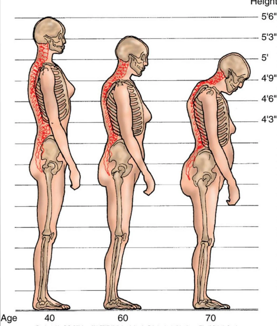 Diagrams illustrating changes in posture and spinal curvature with age, from 40 to 70 years old.