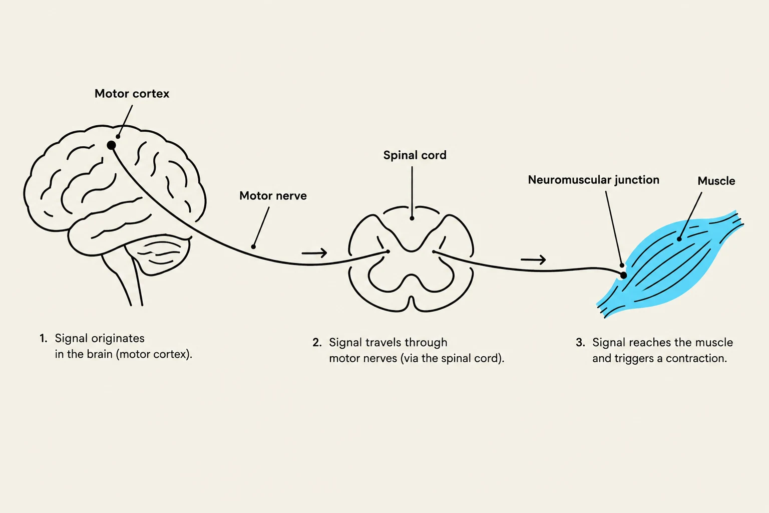 Diagram illustrating the pathway of a motor signal from the brain to a muscle, involving the motor cortex, spinal cord, motor nerves, and neuromuscular junction, leading to muscle contraction.