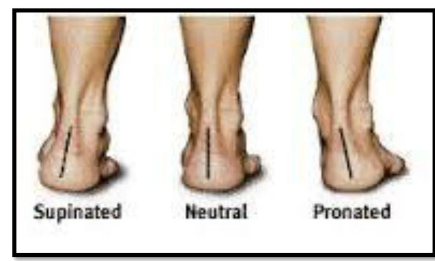 Illustration showing supinated, neutral, and pronated foot postures.