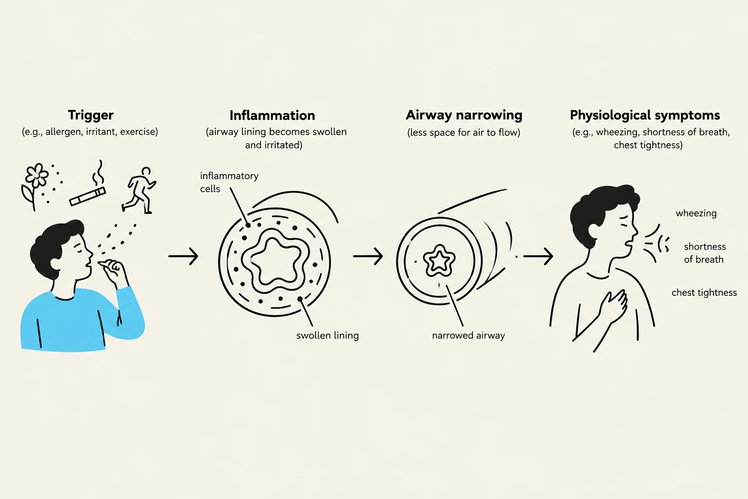 This diagram illustrates the physiological process of asthma, starting with a trigger that leads to inflammation and airway narrowing, resulting in symptoms like wheezing and shortness of breath.