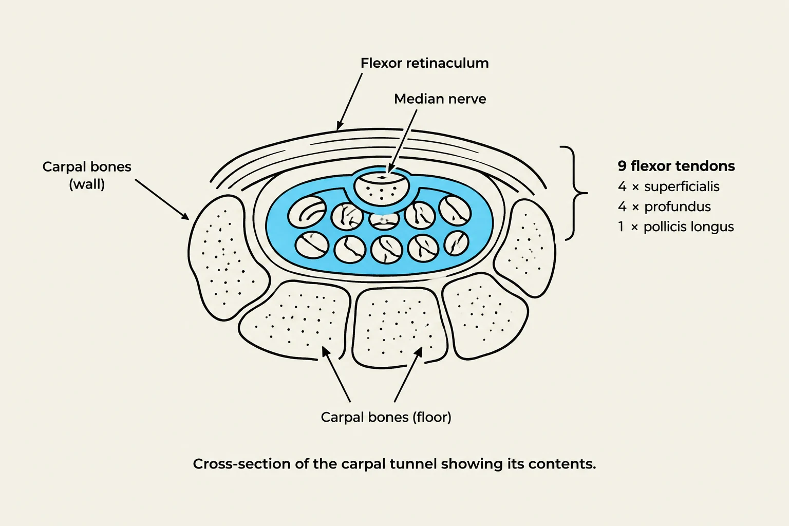 Cross-section of the carpal tunnel showing its contents, including the median nerve and flexor tendons.