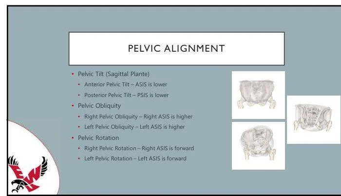 This diagram illustrates pelvic alignment, detailing concepts such as pelvic tilt, obliquity, and rotation, with accompanying anatomical drawings.
