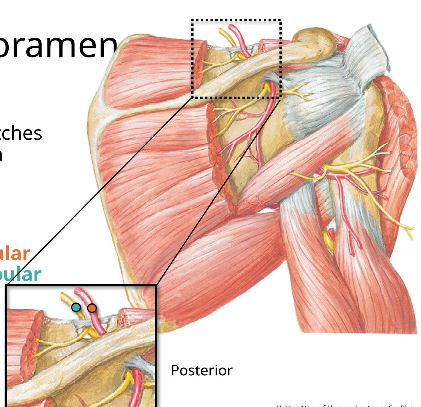 Anatomical illustration of the shoulder region, highlighting muscles, nerves, and blood vessels.