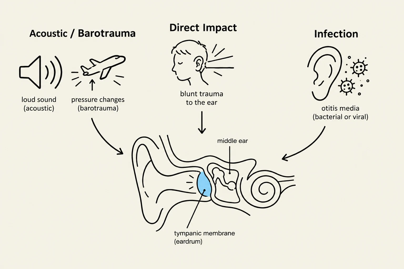 Diagram illustrating causes of ear damage including acoustic trauma, barotrauma, direct impact, and infection.