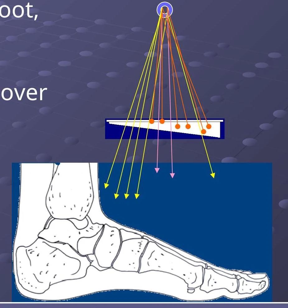 Diagram illustrating the path of radiation through a foot, showing bone structure and beam divergence.