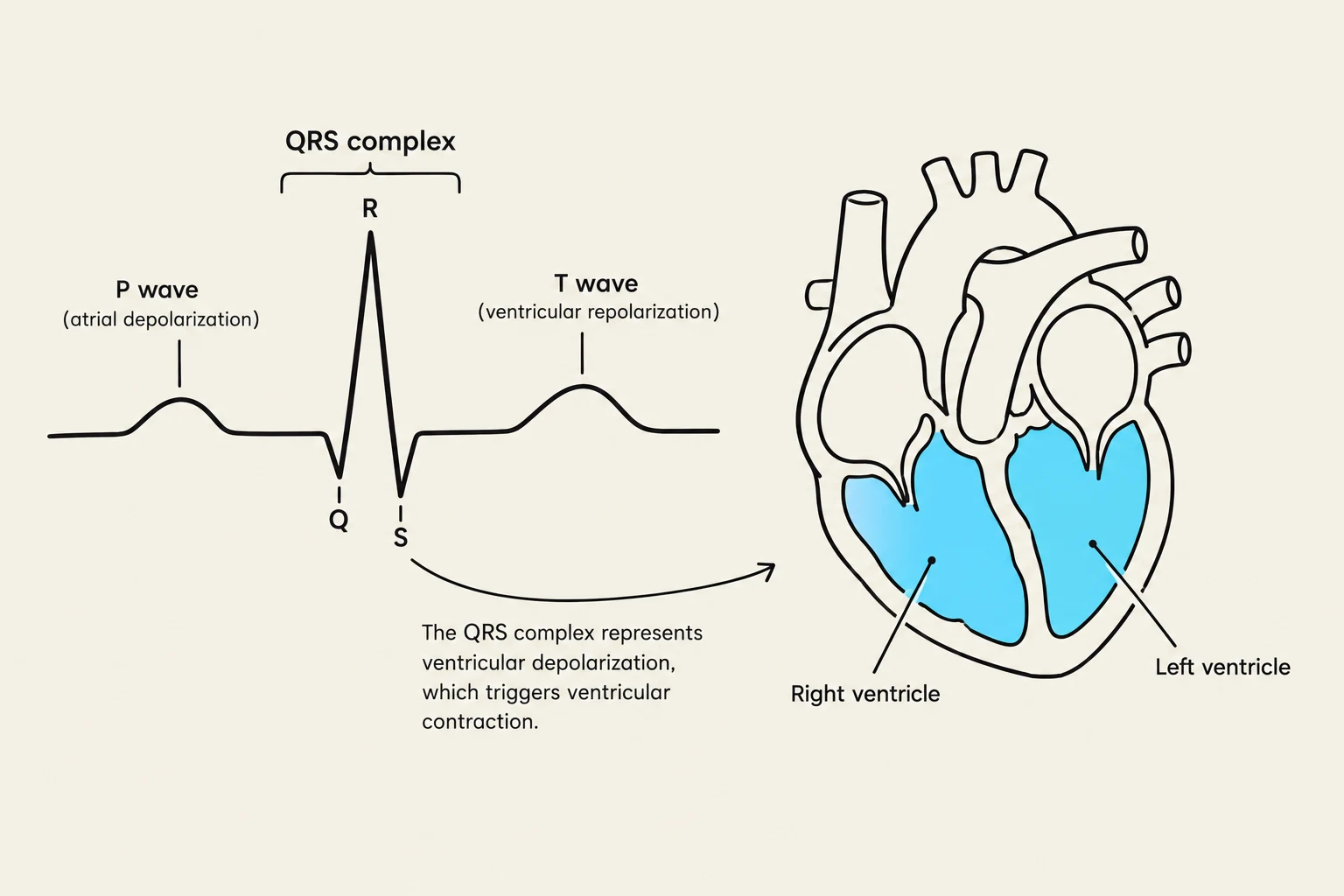 Diagram illustrating the components of an electrocardiogram (ECG) and a cross-section of the heart, showing the right and left ventricles. The ECG shows the P wave (atrial depolarization), QRS complex (ventricular depolarization), and T wave (ventricular repolarization). The text explains that the QRS complex signifies ventricular depolarization, which initiates ventricular contraction.