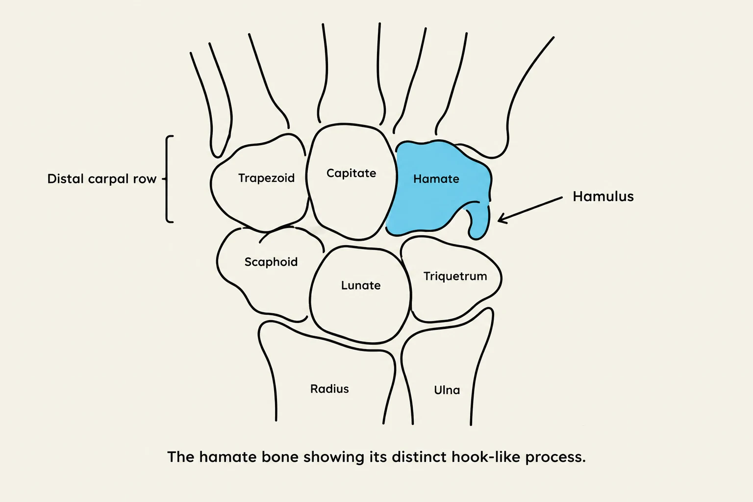 An illustration of the bones of the wrist, highlighting the hamate bone and its hamulus.