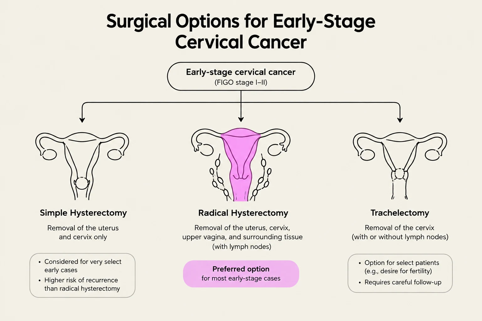 Diagram illustrating surgical options for early-stage cervical cancer, including simple hysterectomy, radical hysterectomy, and trachelectomy.