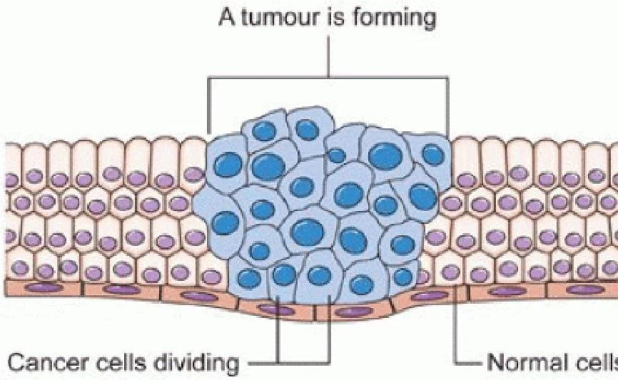 Illustration showing cancer cells dividing and forming a tumor, contrasted with normal cells.