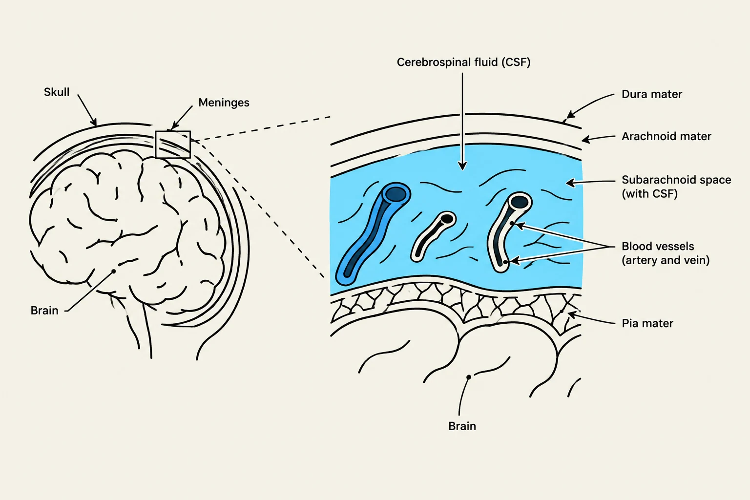 Diagram illustrating the layers of the meninges surrounding the brain, including the dura mater, arachnoid mater, and pia mater, as well as the subarachnoid space containing cerebrospinal fluid (CSF) and blood vessels.