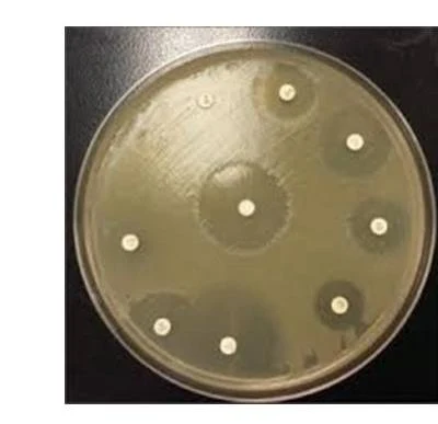 This image shows a petri dish with antibiotic susceptibility testing. The clear zones around the antibiotic discs indicate that the bacteria are susceptible to those antibiotics.