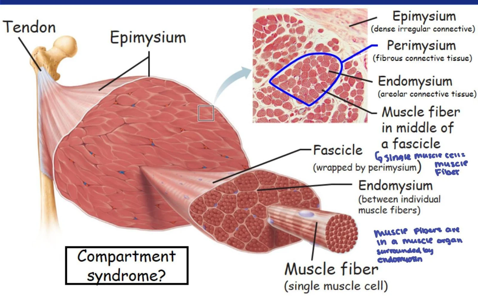 This illustration shows the structure of a muscle, including the tendon, epimysium, perimysium, endomysium, fascicle, and muscle fiber. It also includes a microscopic view of muscle tissue and labels for different connective tissues.