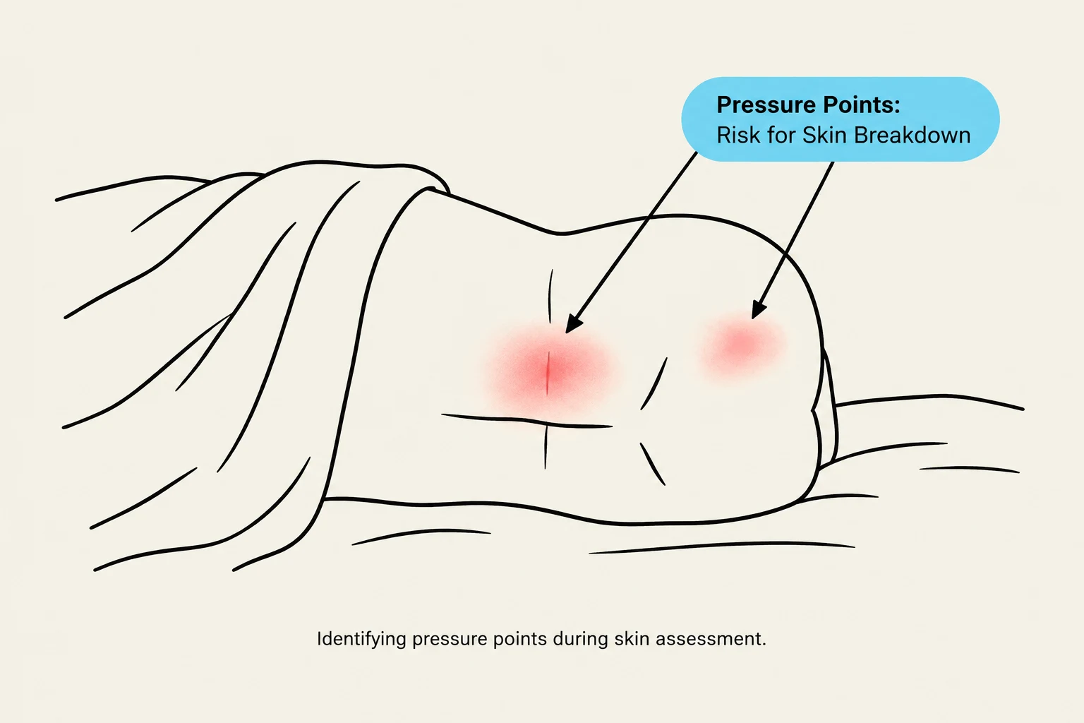 Identifying pressure points during skin assessment.