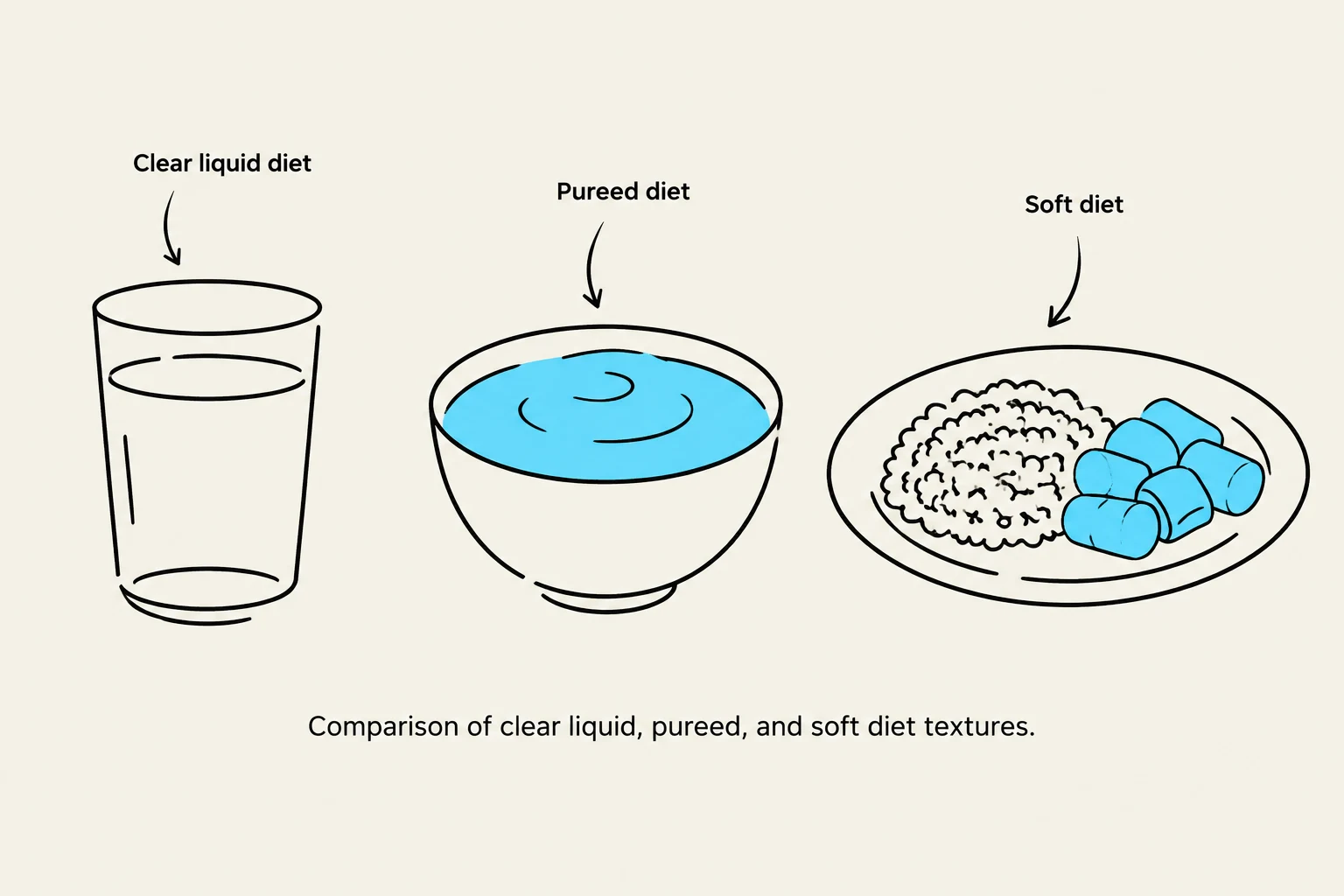 Comparison of clear liquid, pureed, and soft diet textures.