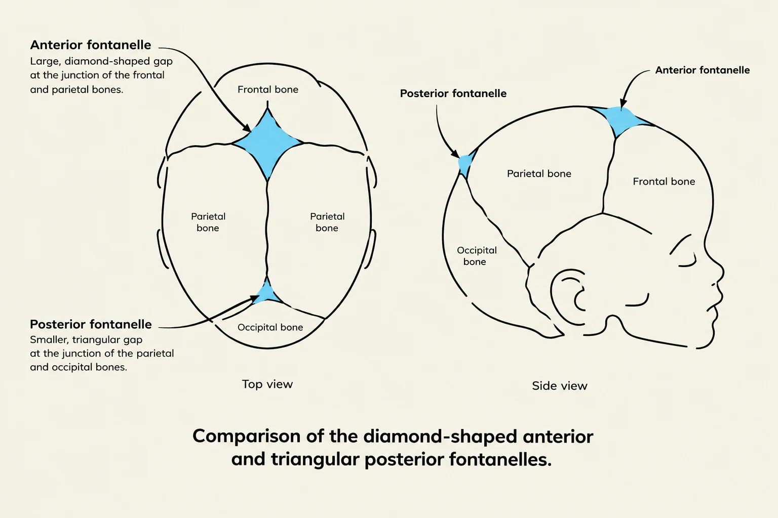 Comparison of the diamond-shaped anterior and triangular posterior fontanelles in a baby's skull.