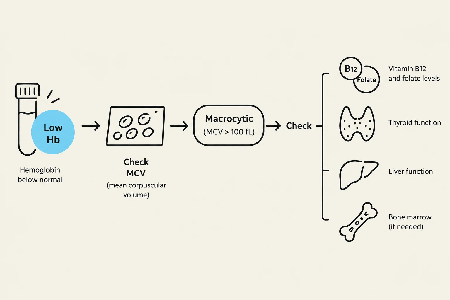 This diagram illustrates a diagnostic flowchart for macrocytic anemia, starting with low hemoglobin levels and checking MCV. It then outlines further investigations including vitamin B12 and folate levels, thyroid function, liver function, and bone marrow assessment if necessary.