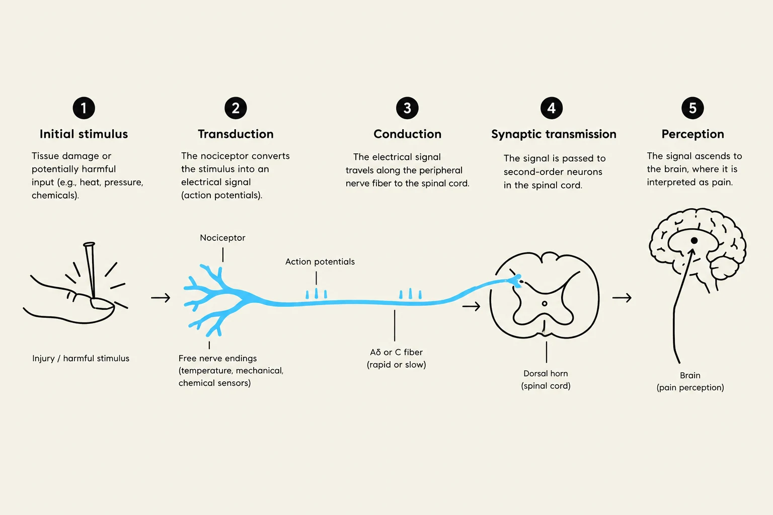This diagram illustrates the five stages of pain perception: initial stimulus, transduction, conduction, synaptic transmission, and perception. It shows how a harmful stimulus is converted into an electrical signal, transmitted along a nerve fiber to the spinal cord, and finally interpreted as pain in the brain.