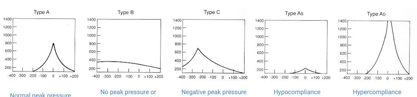 Graphs illustrating different pressure-volume relationships, labeled as Type A (Normal peak pressure), Type B (No peak pressure or), Type C (Negative peak pressure), Type As (Hypocompliance), and Type AD (Hypercompliance).