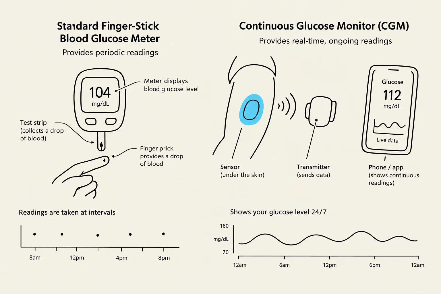 This illustration compares a standard finger-stick blood glucose meter with a continuous glucose monitor (CGM), detailing their respective methods of operation and data display.