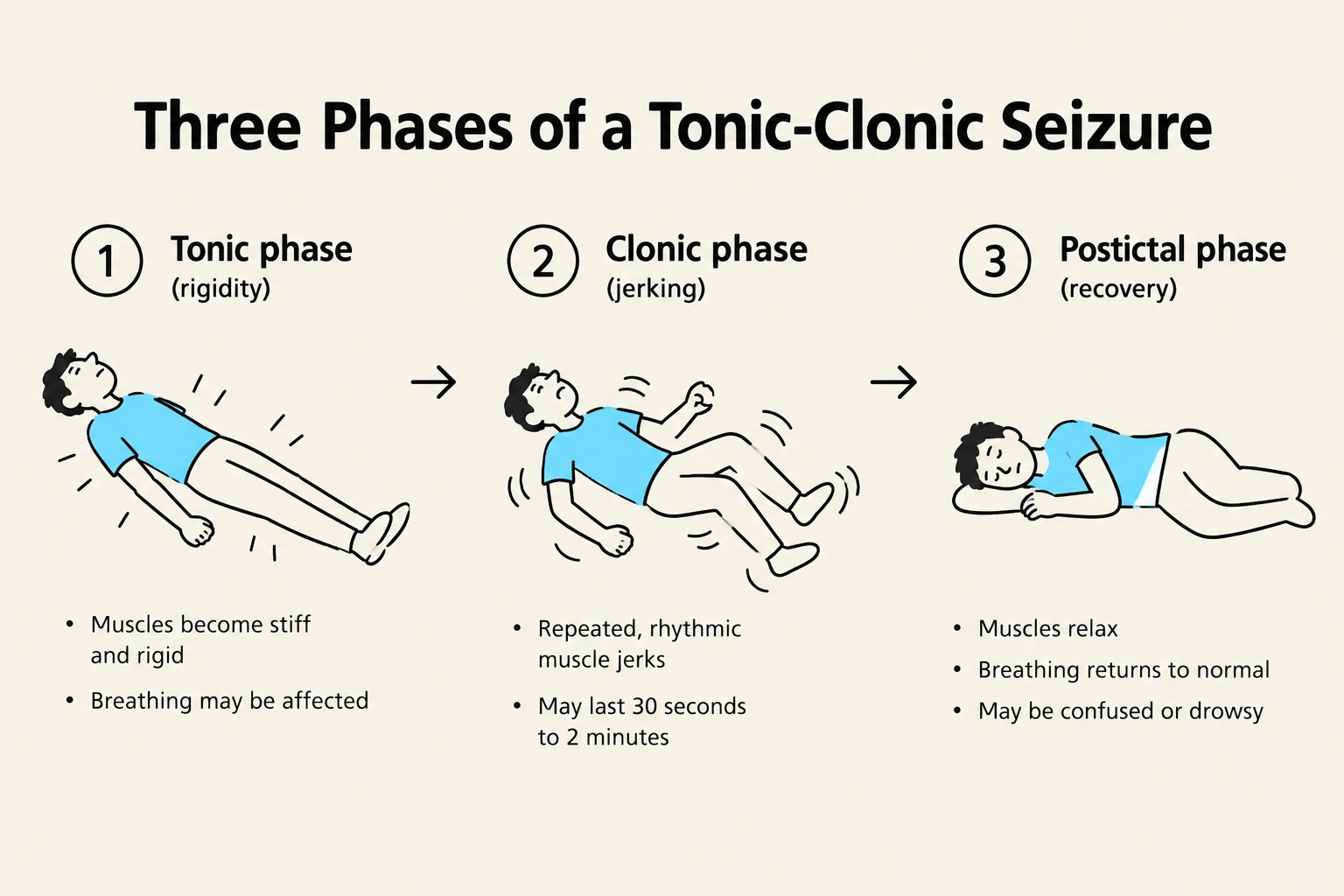 Diagram illustrating the three phases of a tonic-clonic seizure: tonic phase (rigidity), clonic phase (jerking), and postictal phase (recovery).