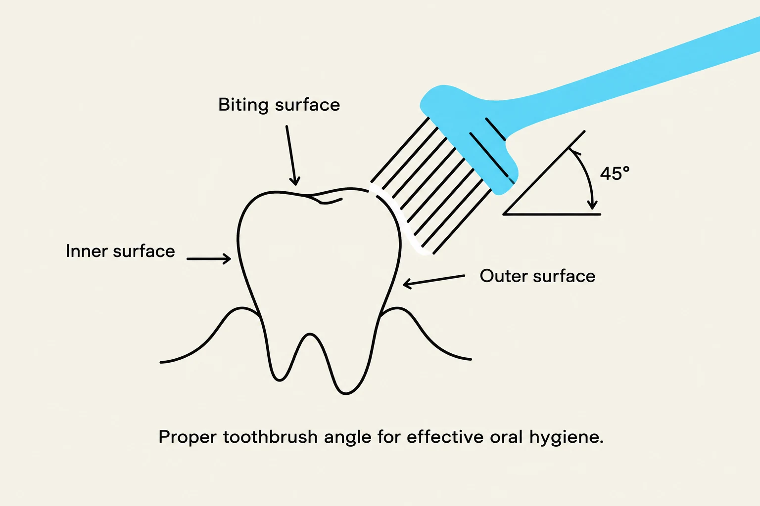 Diagram illustrating the correct 45-degree angle for brushing the outer surface of a tooth for effective oral hygiene.