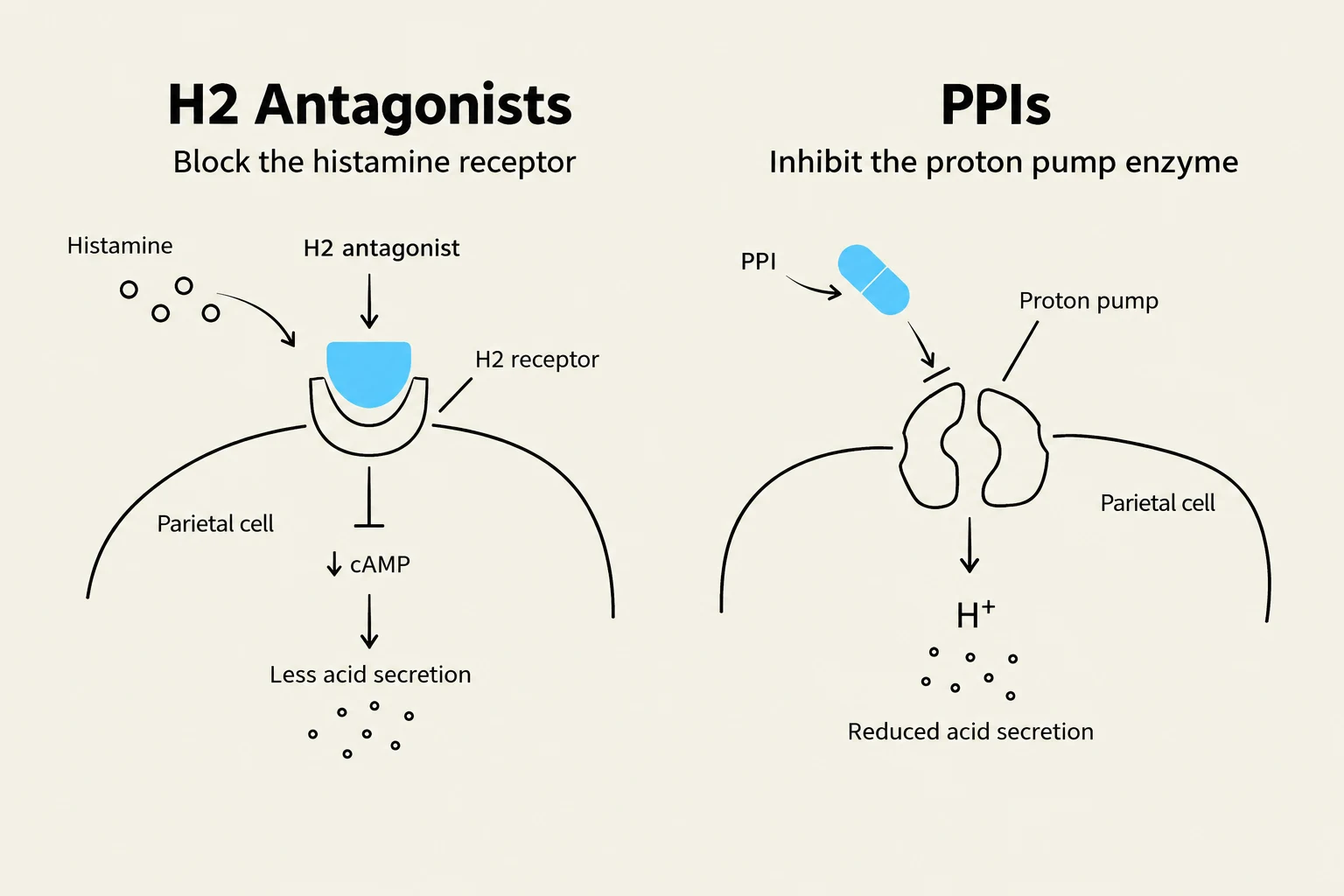 Diagrams illustrating the mechanisms of H2 antagonists and proton pump inhibitors (PPIs) in reducing stomach acid secretion.