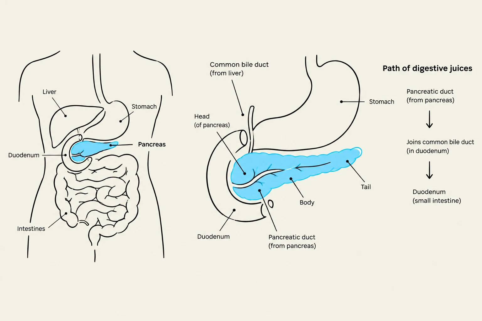 Diagram illustrating the pancreas, liver, stomach, and intestines, along with the path of digestive juices.