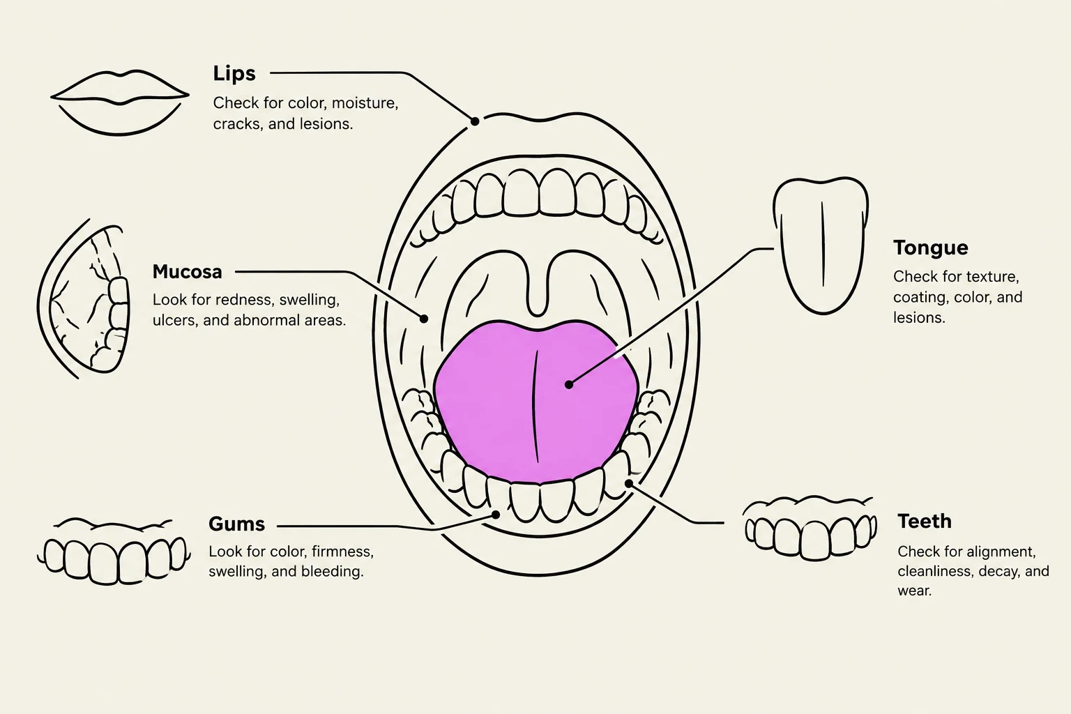 Diagram illustrating the parts of the mouth and what to check for regarding their health.
