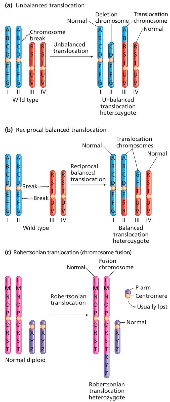 Diagrams illustrating three types of chromosomal translocations: unbalanced translocation, reciprocal balanced translocation, and Robertsonian translocation (chromosome fusion).