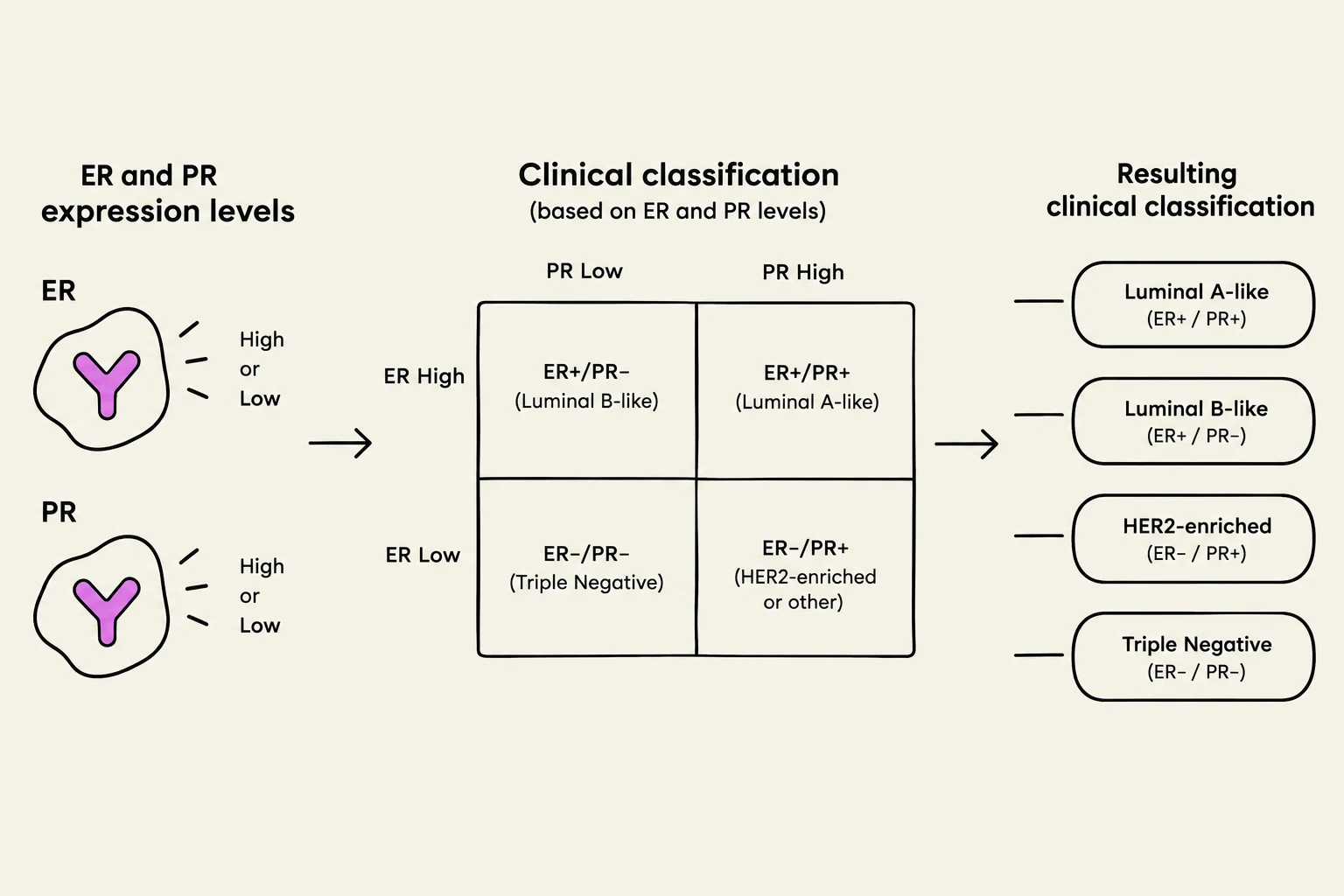 This diagram illustrates the clinical classification of breast cancer based on the expression levels of Estrogen Receptor (ER) and Progesterone Receptor (PR). It shows how different combinations of ER and PR levels (High/Low) lead to specific classifications such as Luminal A-like, Luminal B-like, HER2-enriched, and Triple Negative.