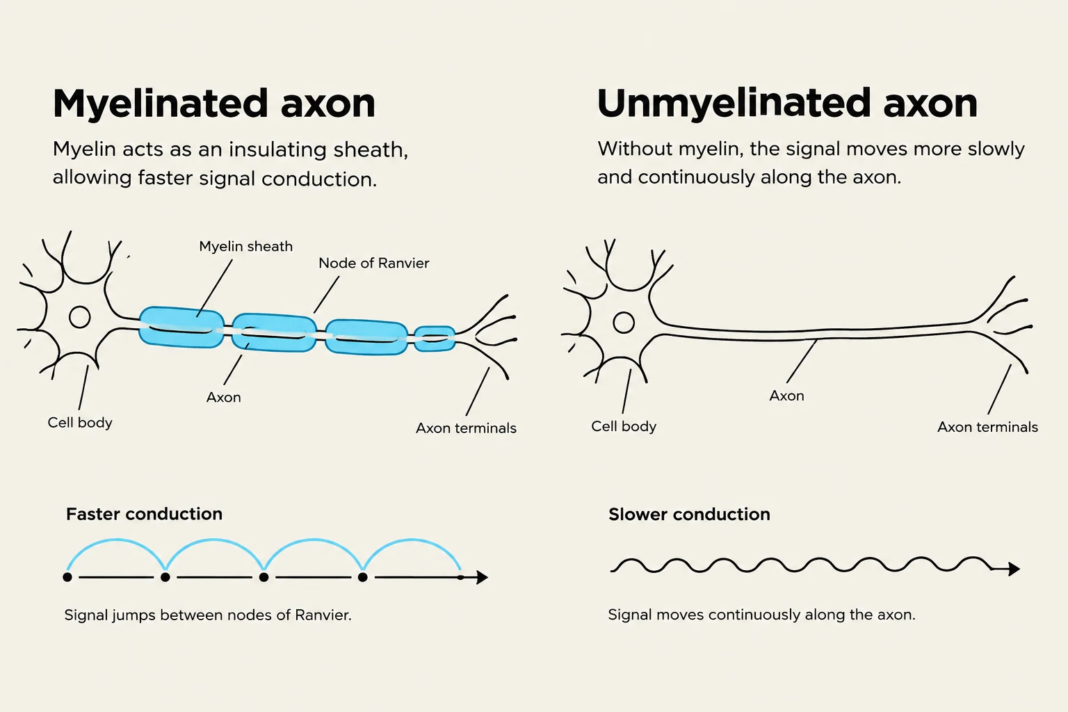 Diagrams illustrating the difference between myelinated and unmyelinated axons and their impact on signal conduction speed.