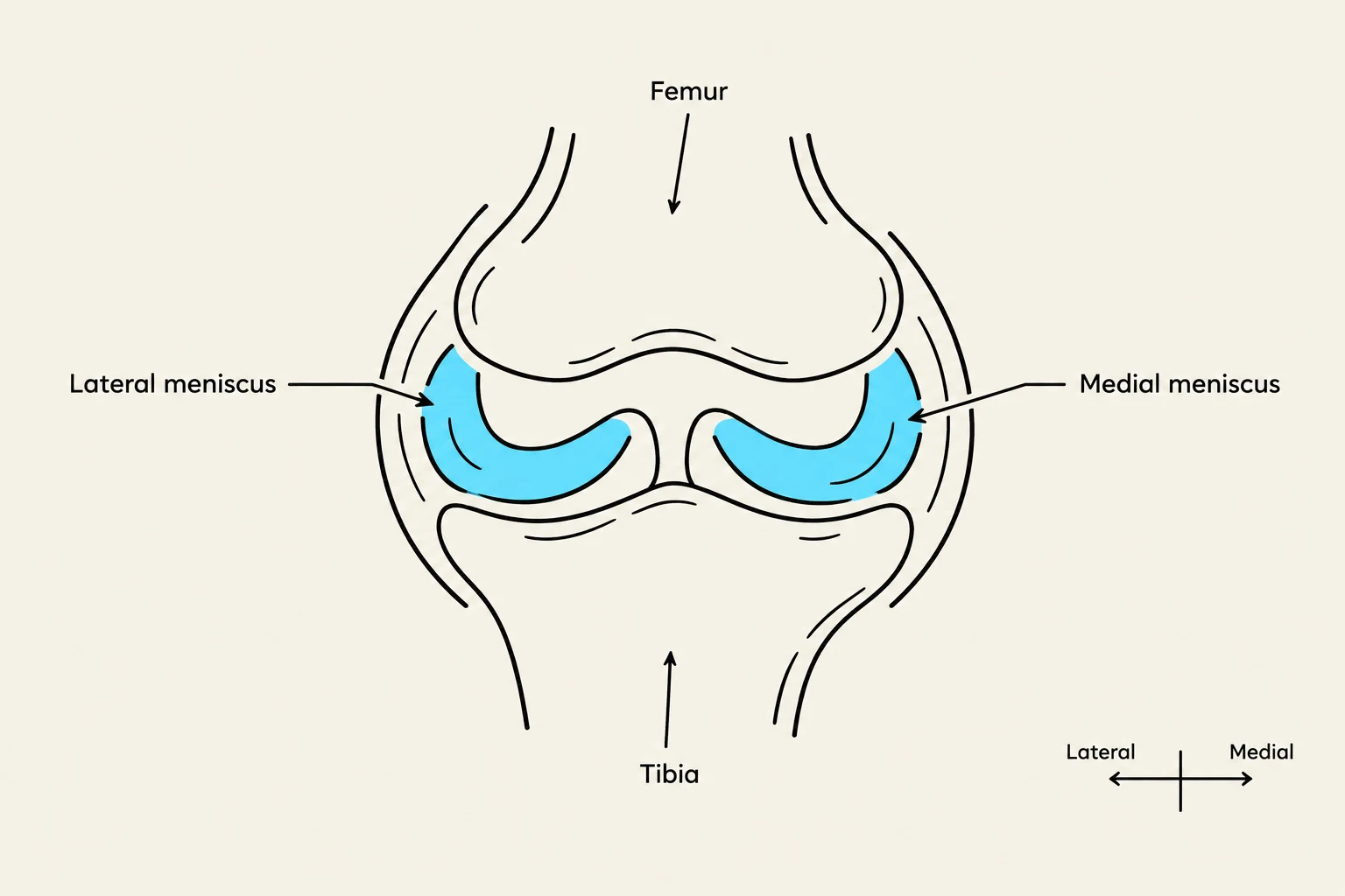 Diagram of the human knee joint, illustrating the femur, tibia, and menisci.
