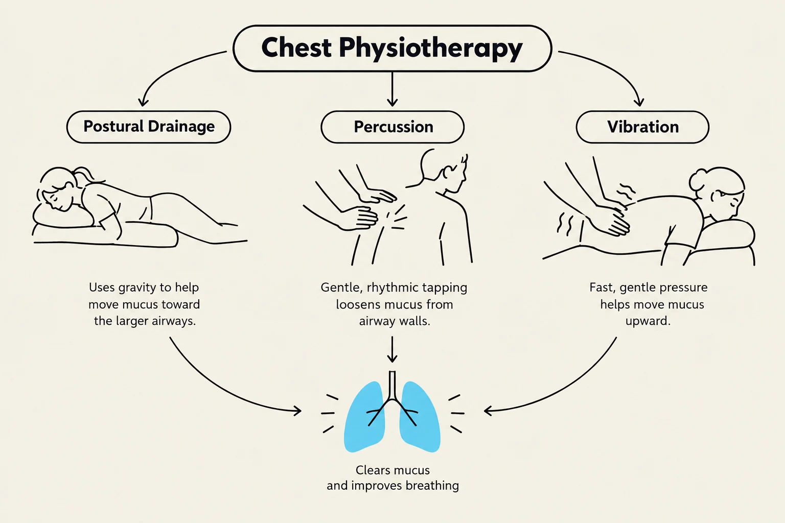 This diagram illustrates chest physiotherapy techniques including postural drainage, percussion, and vibration, all aimed at clearing mucus and improving breathing.