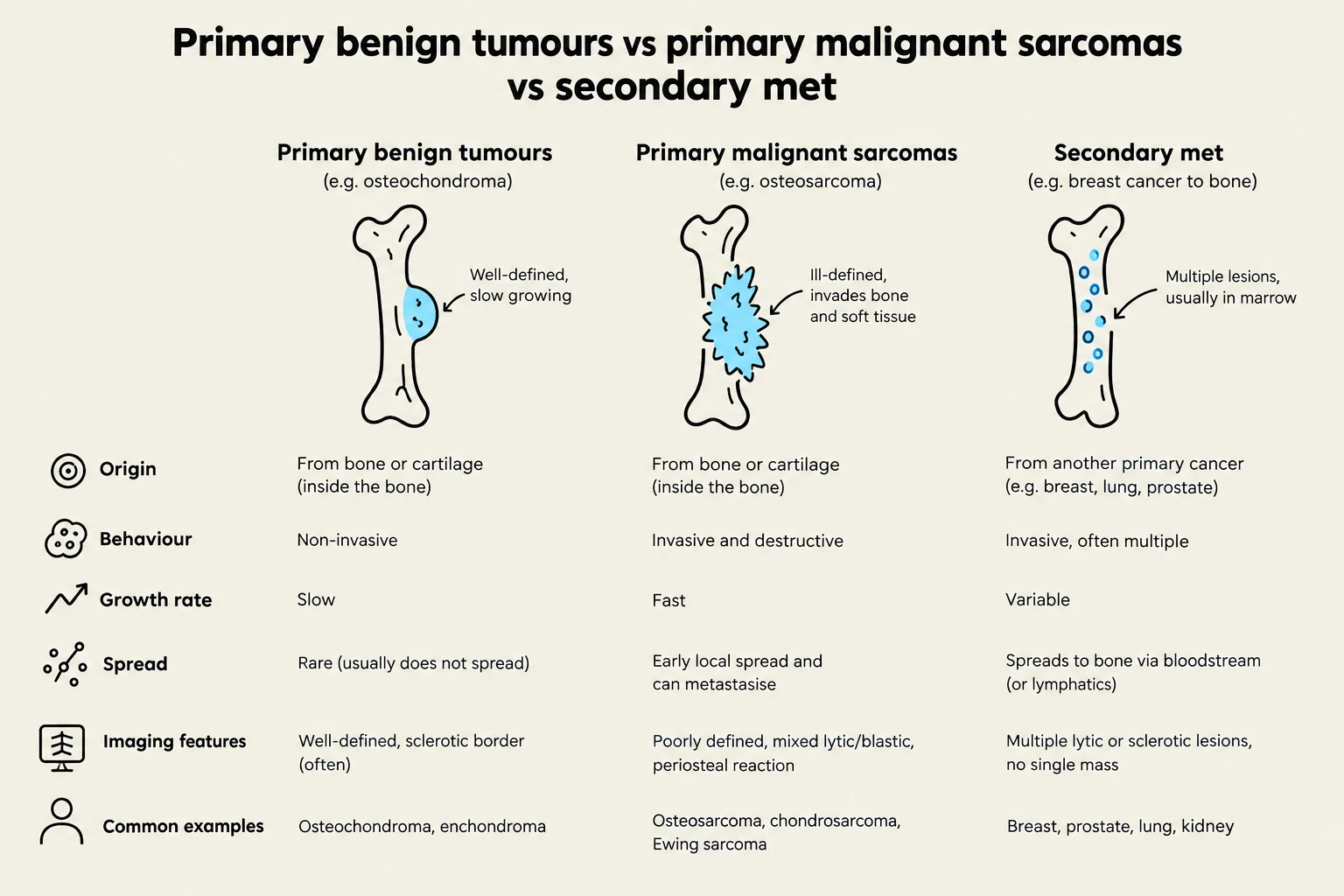 Comparison of primary benign tumors, primary malignant sarcomas, and secondary metastases in bone, detailing their origin, behavior, growth rate, spread, imaging features, and common examples.