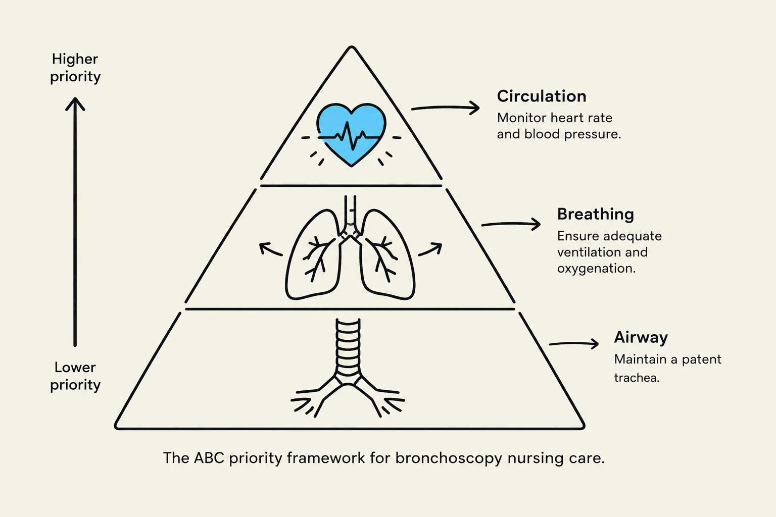 The ABC priority framework for bronchoscopy nursing care, illustrating Circulation, Breathing, and Airway as priorities.
