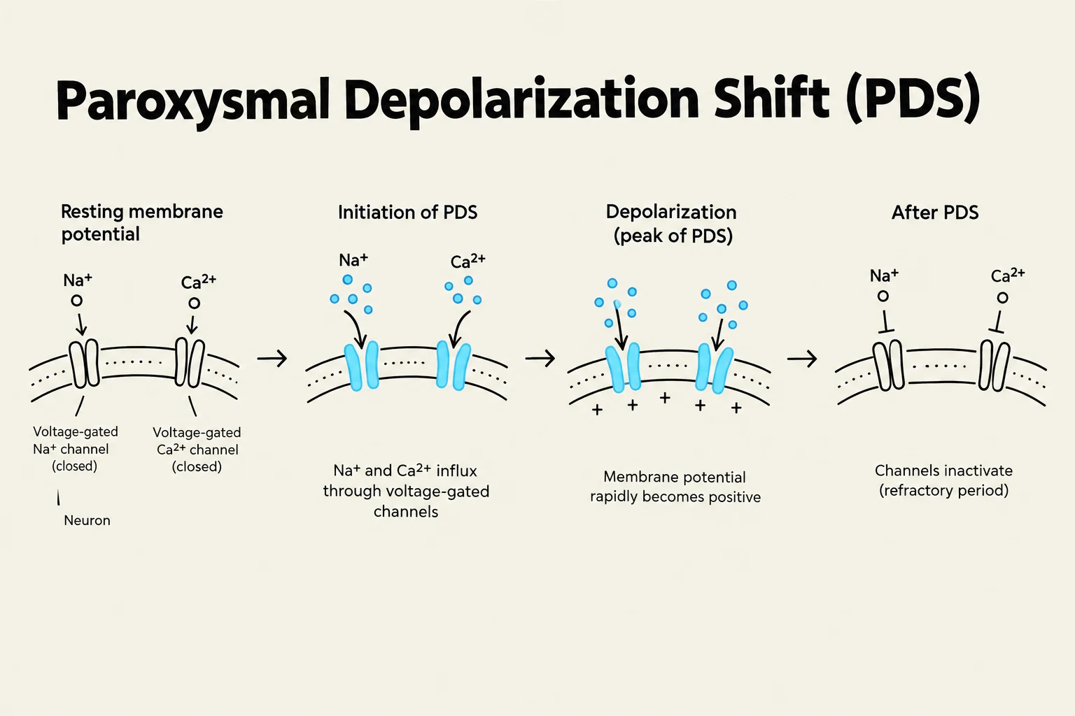 Diagram illustrating the process of a Paroxysmal Depolarization Shift (PDS) in a neuron, showing the influx of sodium and calcium ions through voltage-gated channels, leading to a rapid change in membrane potential and subsequent channel inactivation.