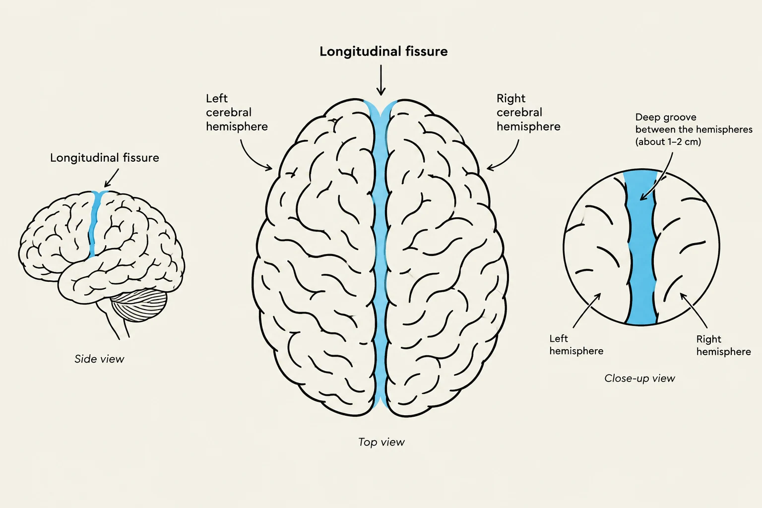 Diagrams illustrating the longitudinal fissure of the human brain from side, top, and close-up views, highlighting the division between the left and right cerebral hemispheres.