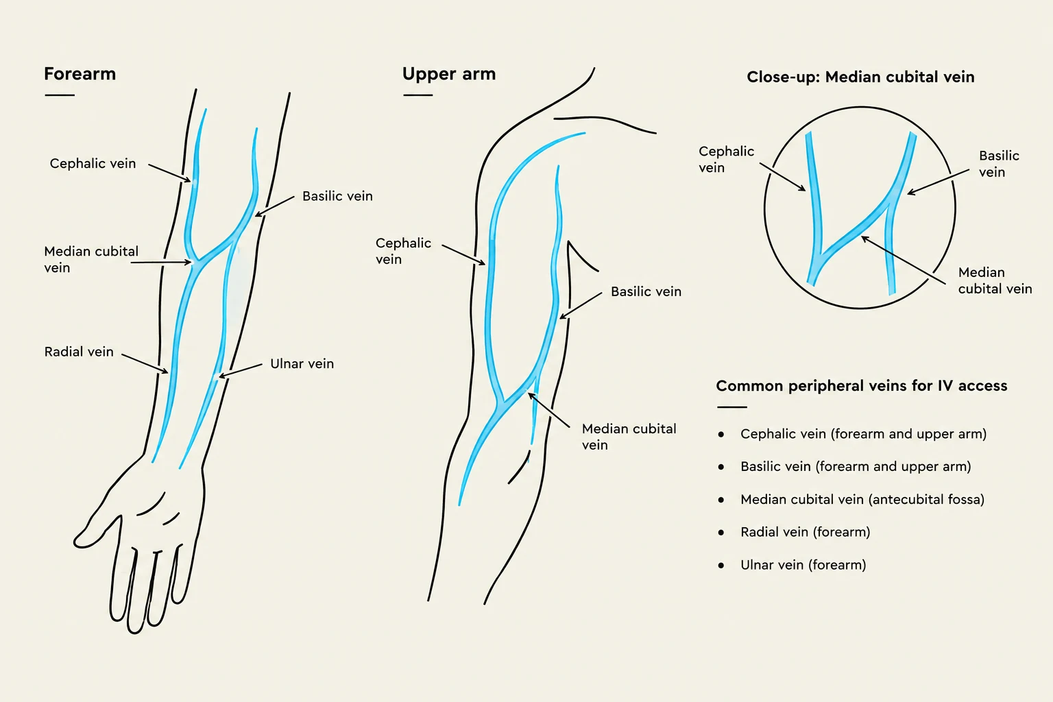 Diagrams illustrating common peripheral veins in the forearm and upper arm, including a close-up of the median cubital vein and a list of veins commonly used for IV access.