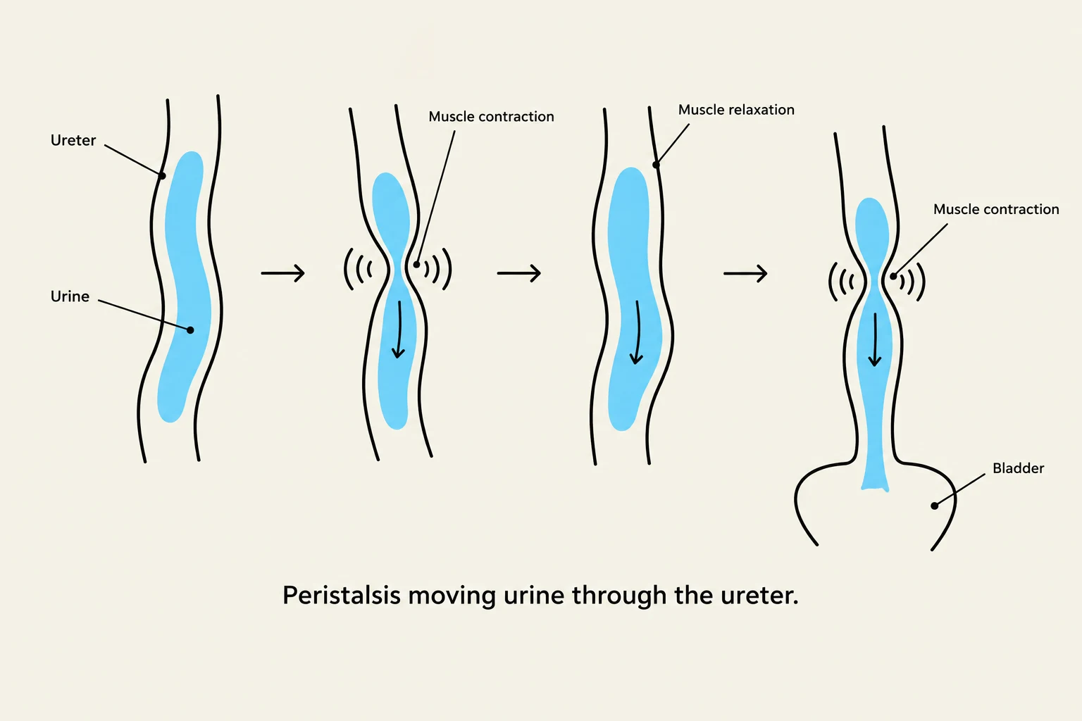 Diagram illustrating peristalsis, the muscular contractions that move urine through the ureter to the bladder.