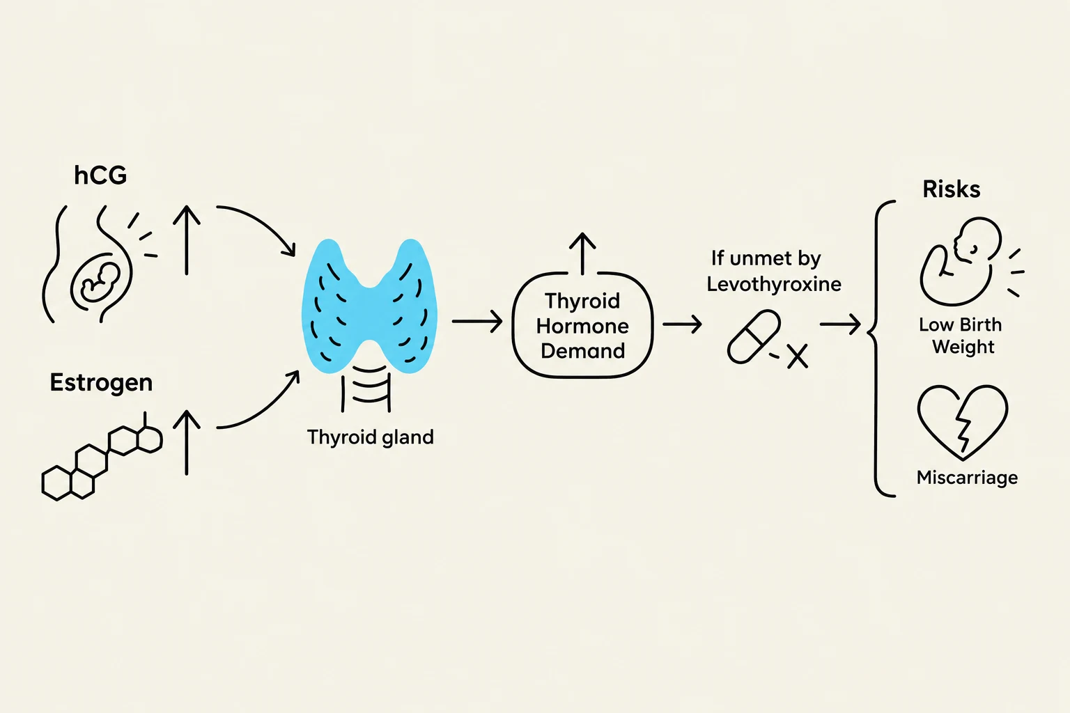 This diagram illustrates the relationship between hCG, estrogen, and the thyroid gland, showing how unmet thyroid hormone demand during pregnancy can lead to risks such as low birth weight and miscarriage.