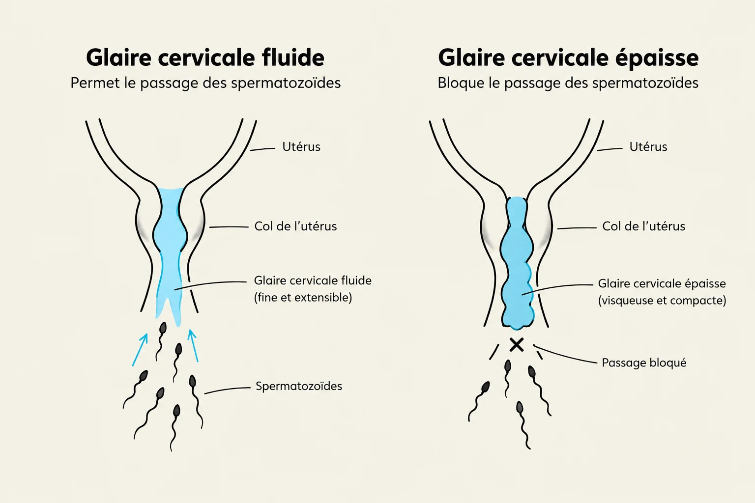 Diagram illustrating the difference between fluid cervical mucus, which allows sperm passage, and thick cervical mucus, which blocks sperm passage.