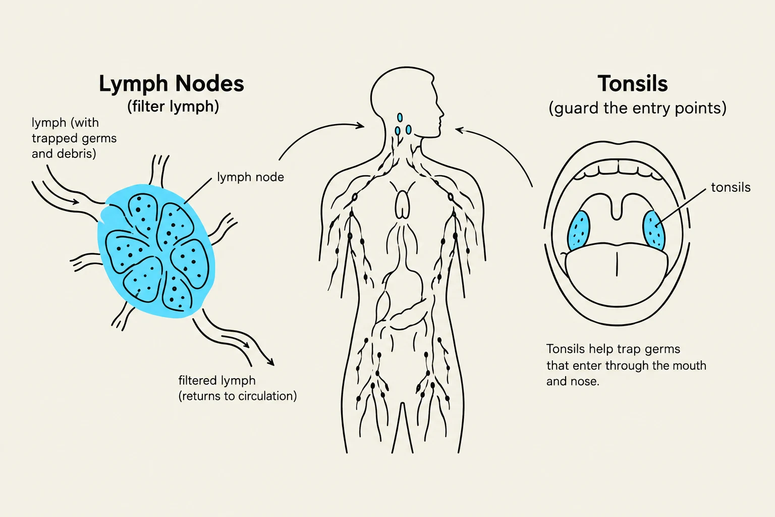 This illustration shows the location and function of lymph nodes and tonsils within the human body. Lymph nodes filter lymph, trapping germs and debris, while tonsils guard the entry points of the mouth and nose, helping to trap incoming germs.